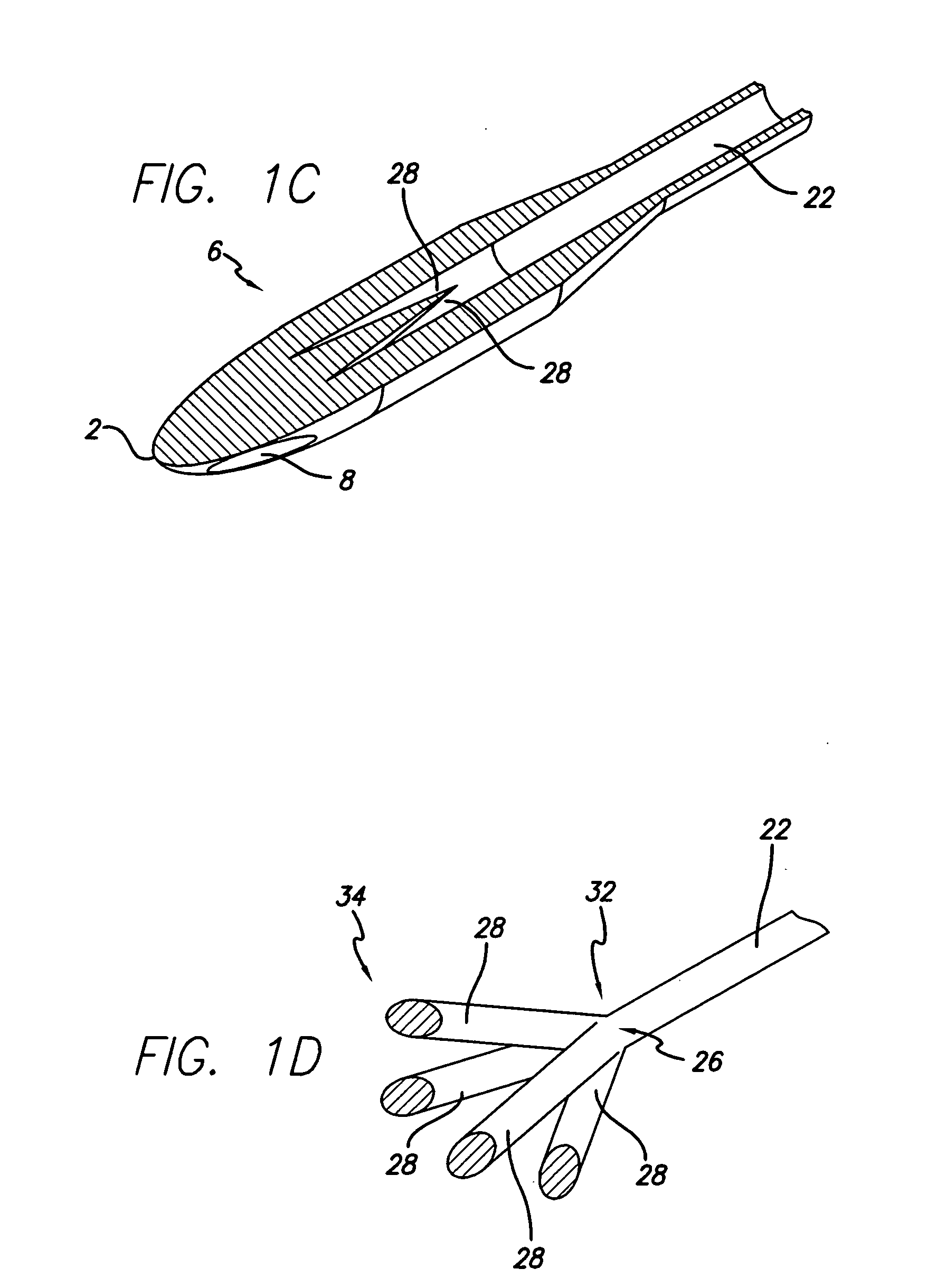 Reduction of recirculation in catheters