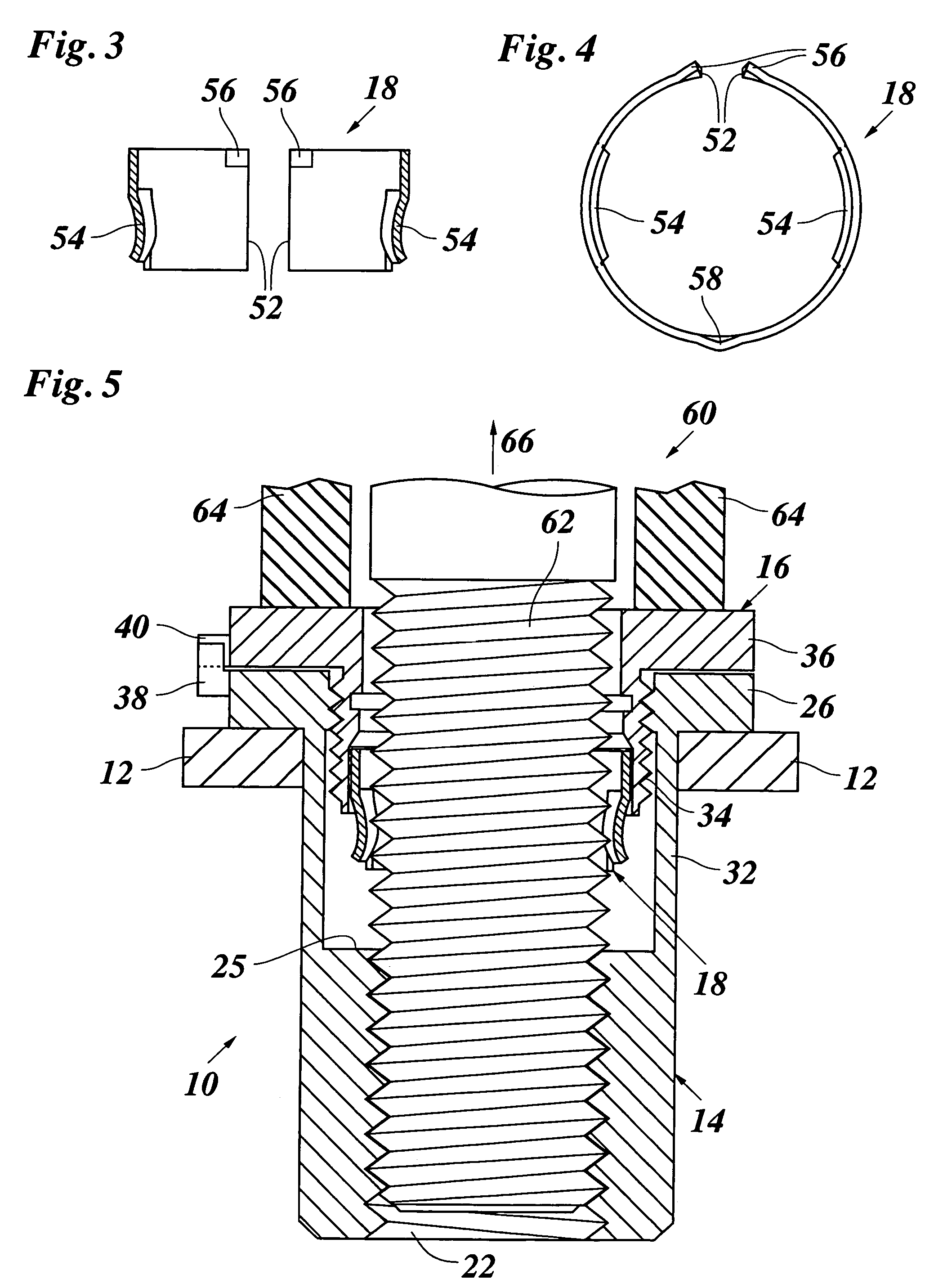 Device for connecting component parts, comprising a blind rivet fastener