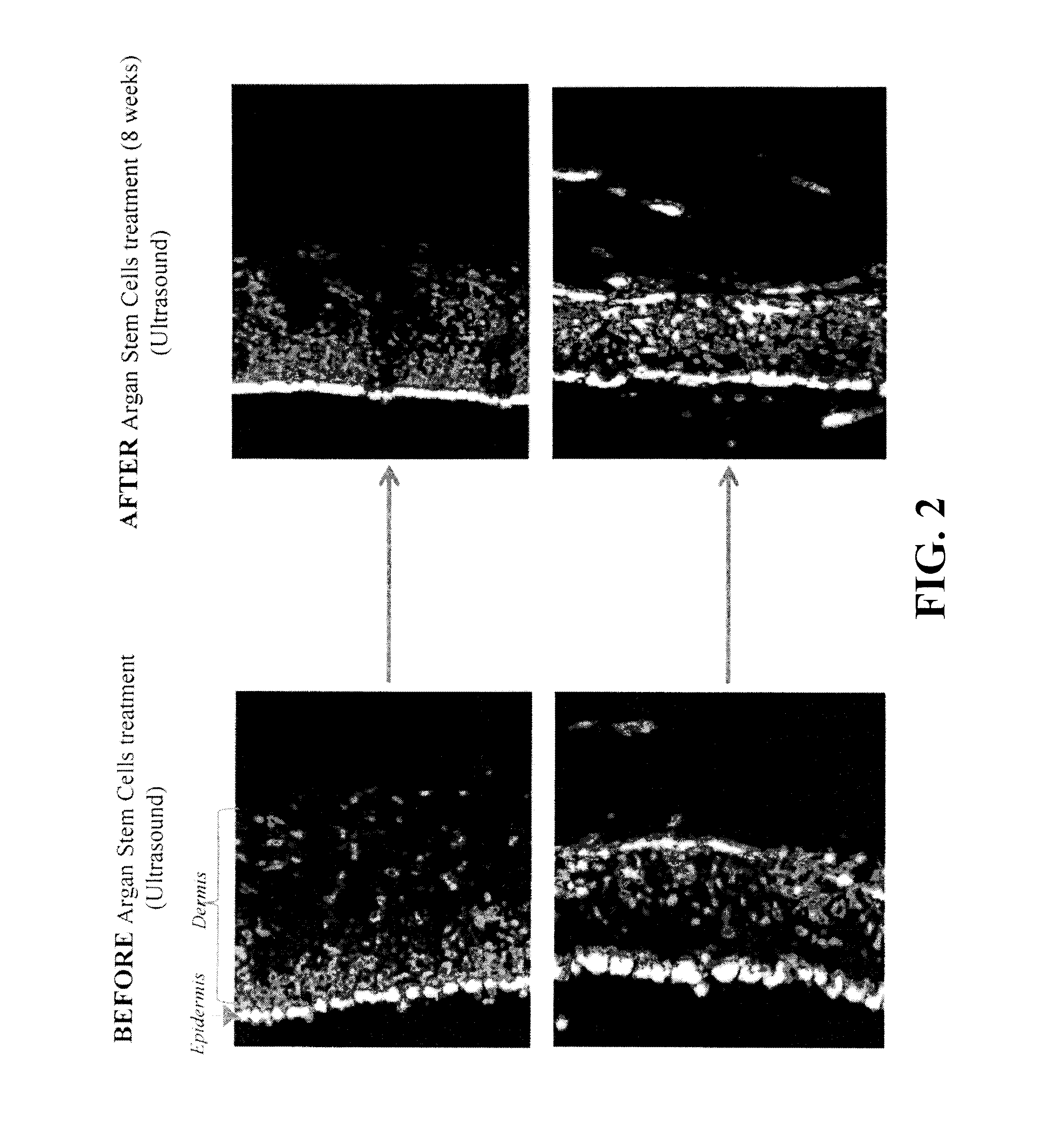 Skin cosmetic compositions comprising malus domestica extract and argania spinosa sprout extract for improving skin appearance