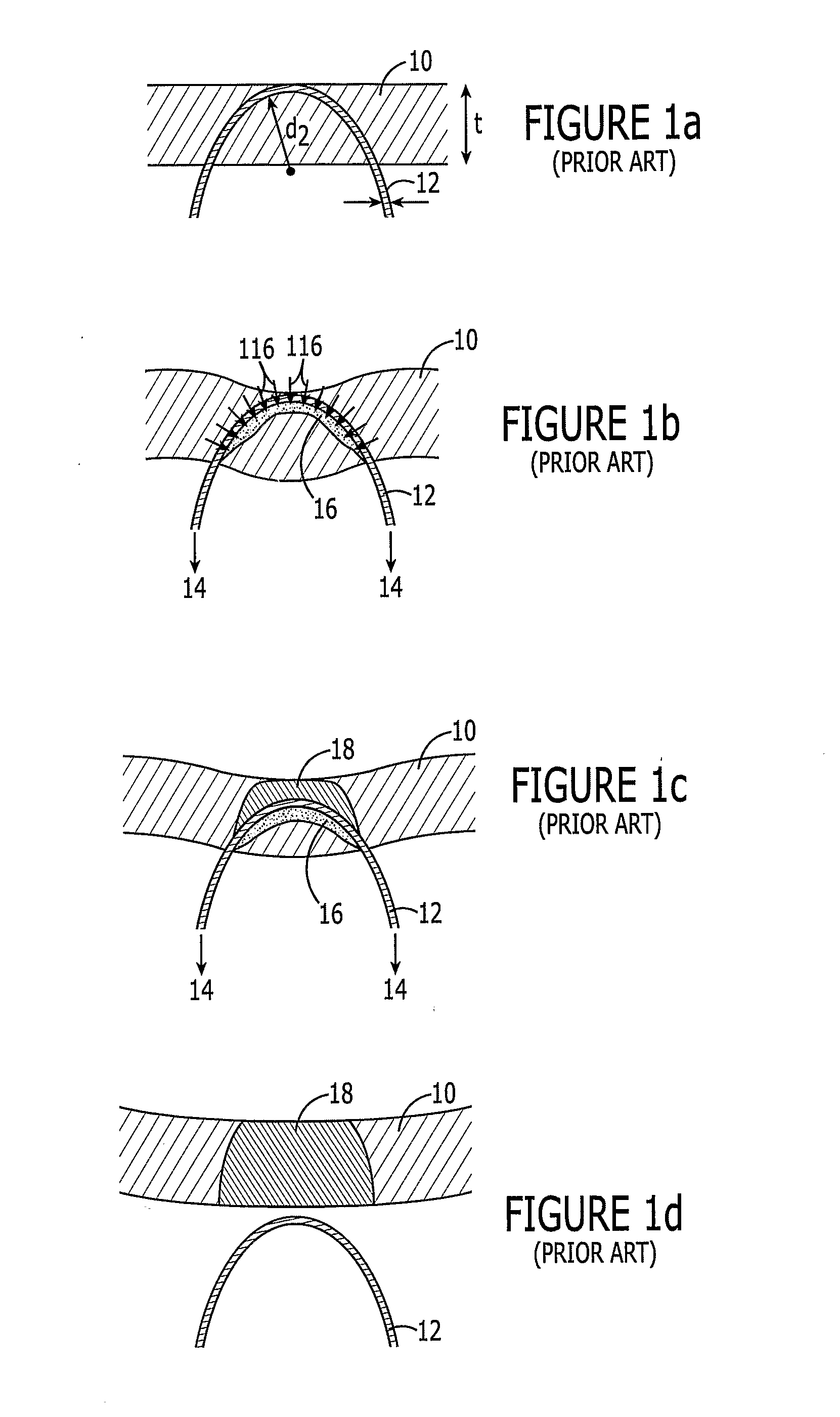 Soft Tissue Anchoring Methods and Devices