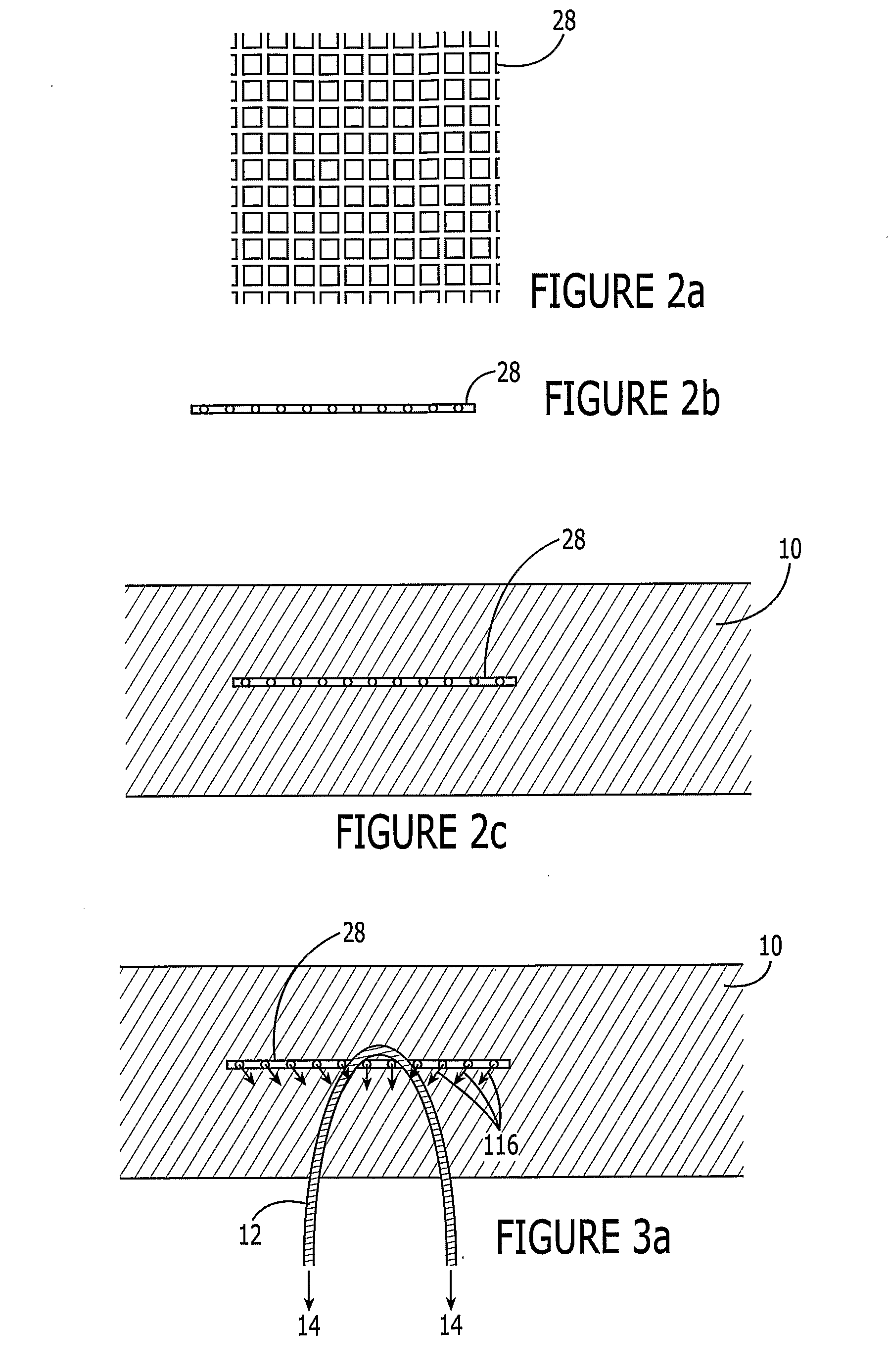 Soft Tissue Anchoring Methods and Devices