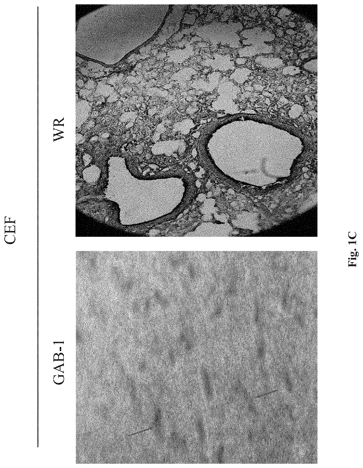 Therapeutic vaccine for the treatment of papillomavirus lesions