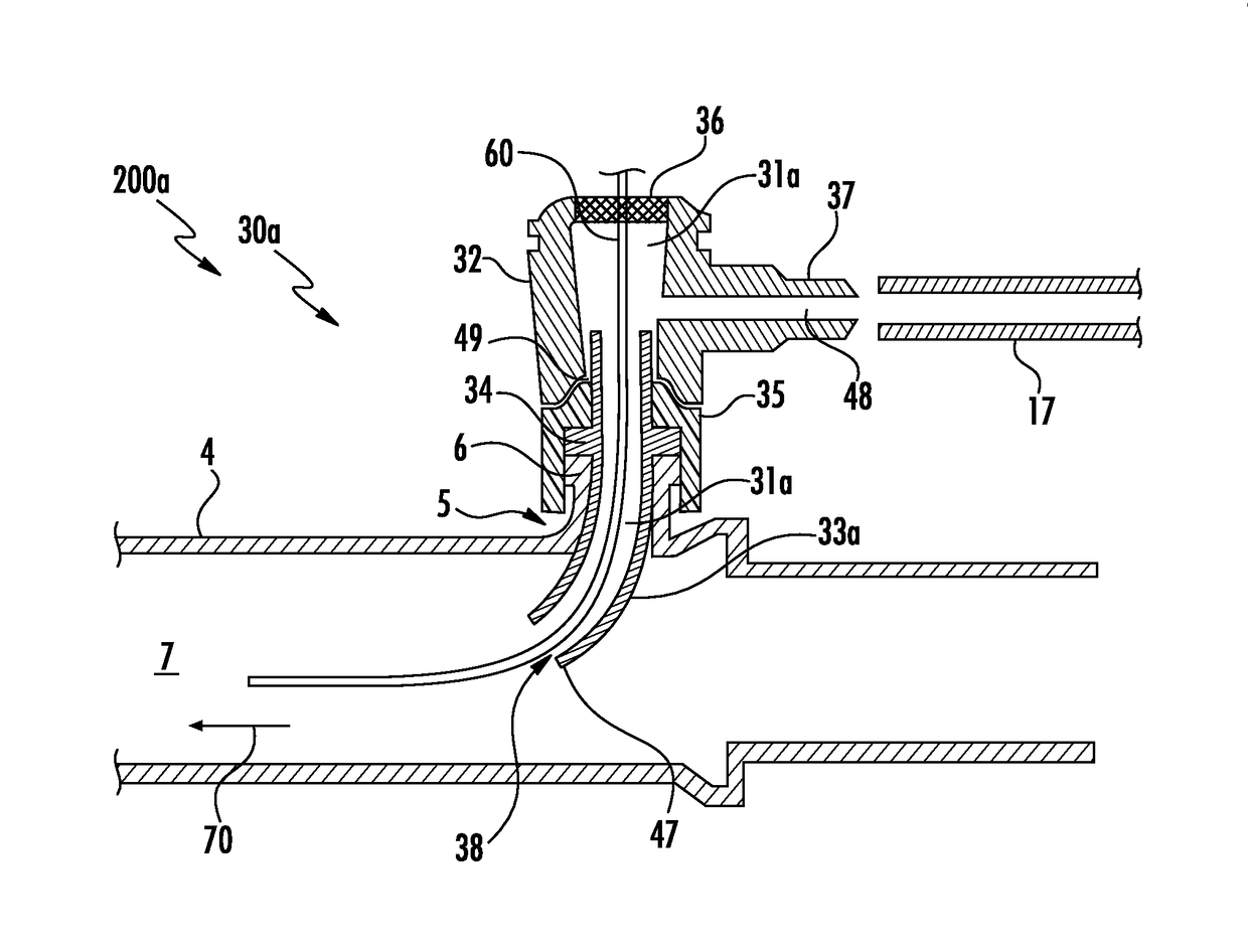 Devices for Endovascular Access Through Extracorporeal Life Support Circuits