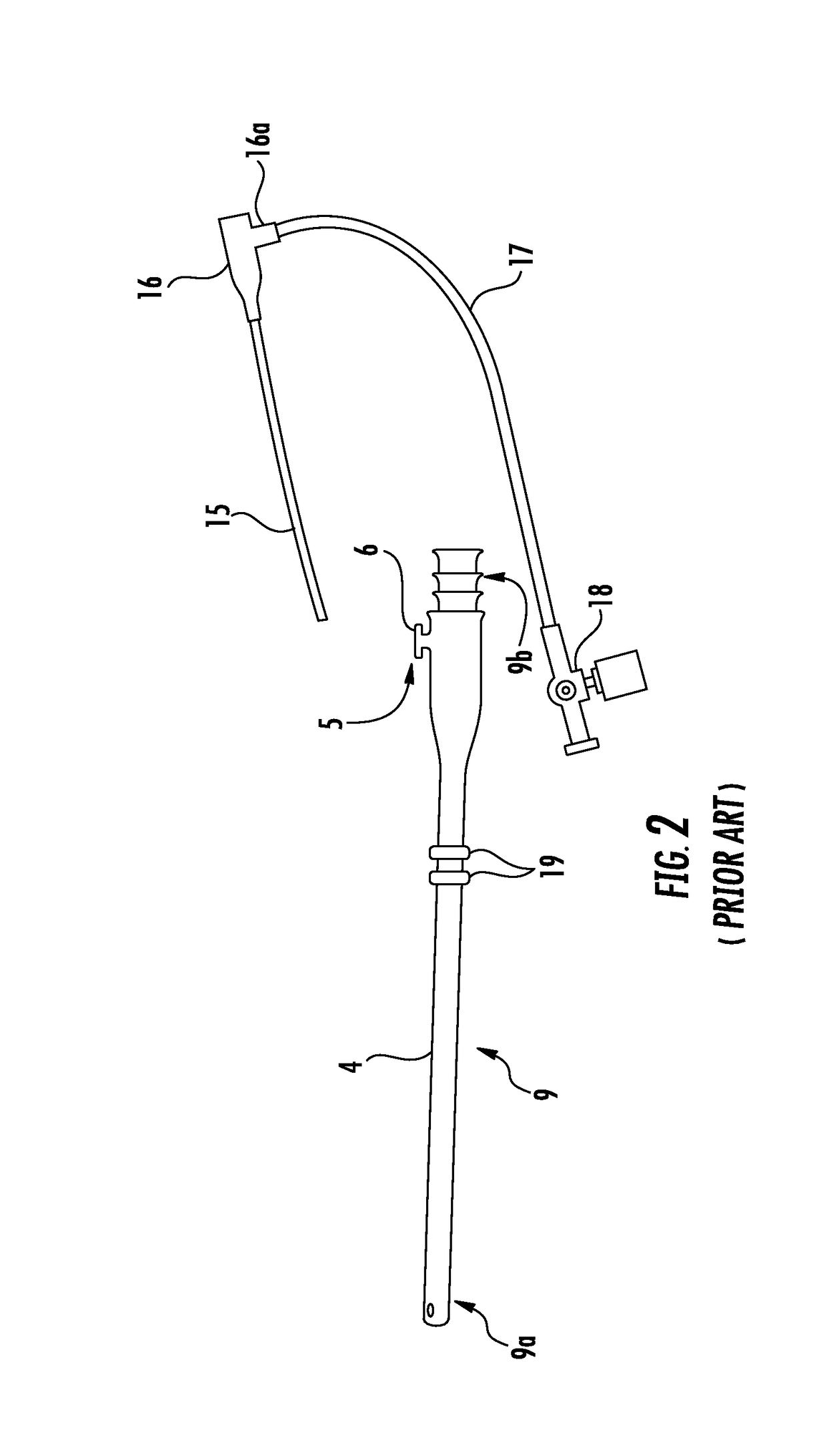 Devices for Endovascular Access Through Extracorporeal Life Support Circuits