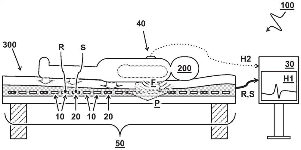 Cardiac monitoring system and method