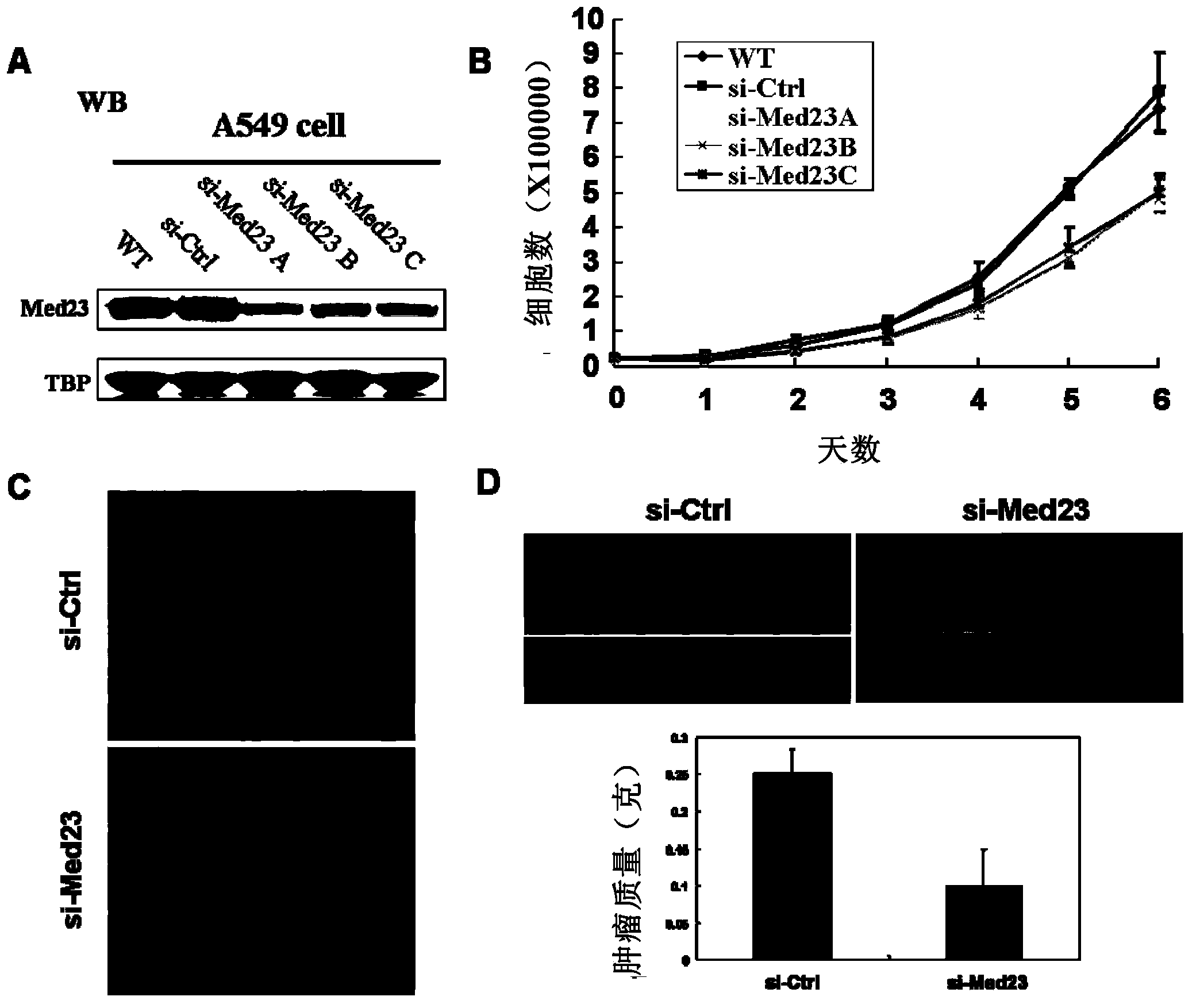 Transcription mesosome Med23 subunit serving as target for preventing or treating cancer