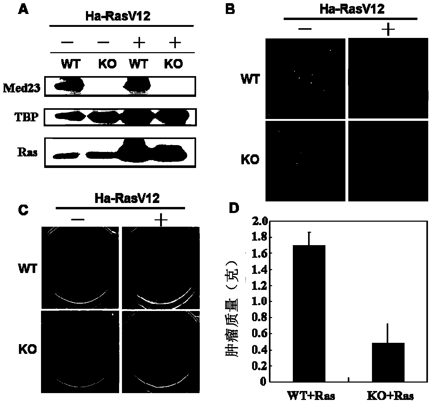 Transcription mesosome Med23 subunit serving as target for preventing or treating cancer