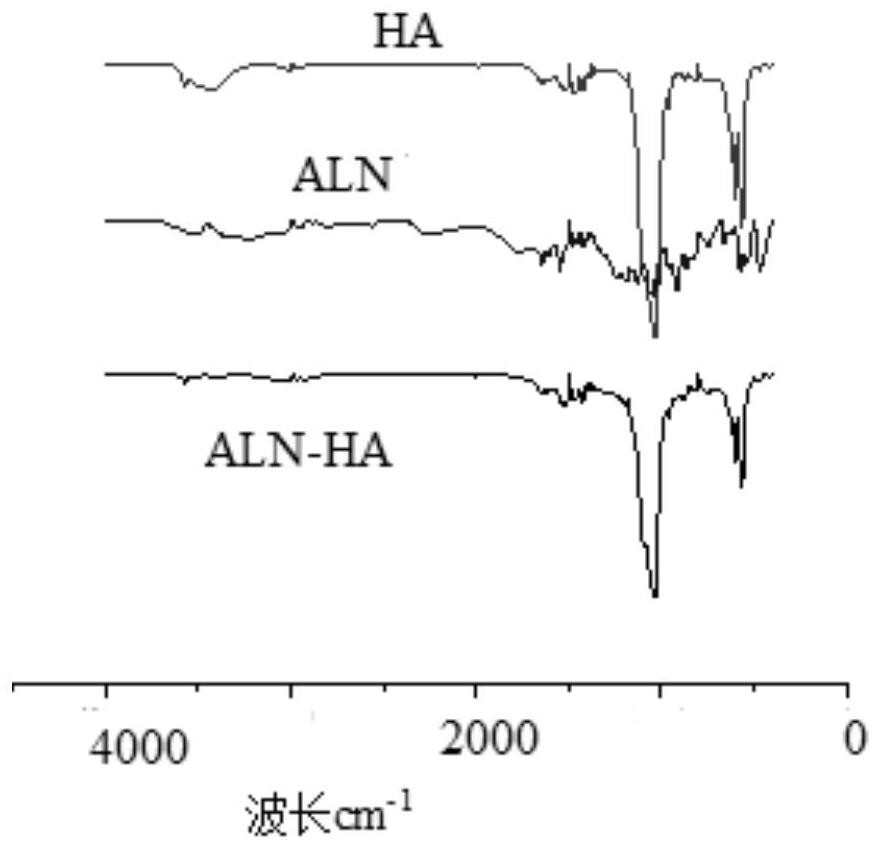 A kind of composite medical bio-bone cement and its preparation method and application