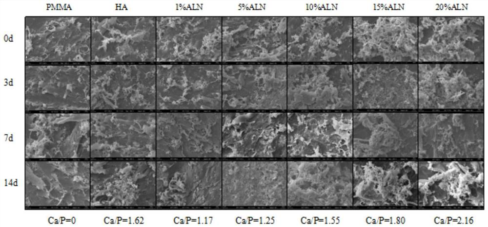 A kind of composite medical bio-bone cement and its preparation method and application