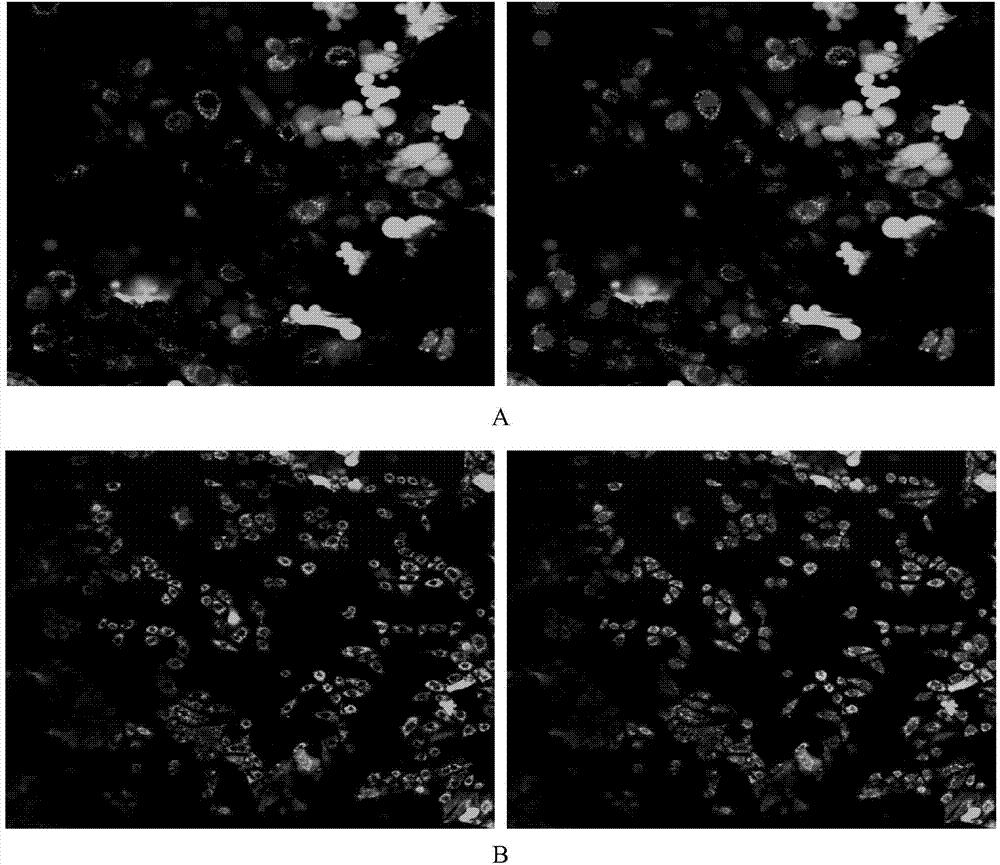 Modified cellulose nanofiber membrane based on layer-by-layer self-assembly of lysozyme and silk protein based as well as preparation and application thereof