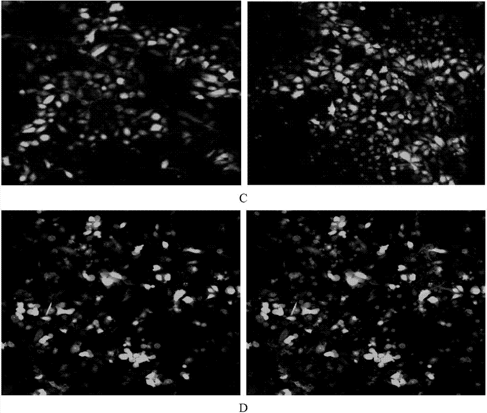 Modified cellulose nanofiber membrane based on layer-by-layer self-assembly of lysozyme and silk protein based as well as preparation and application thereof