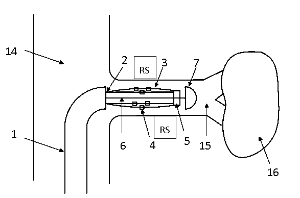 Multi-electrode renal artery ablation catheter