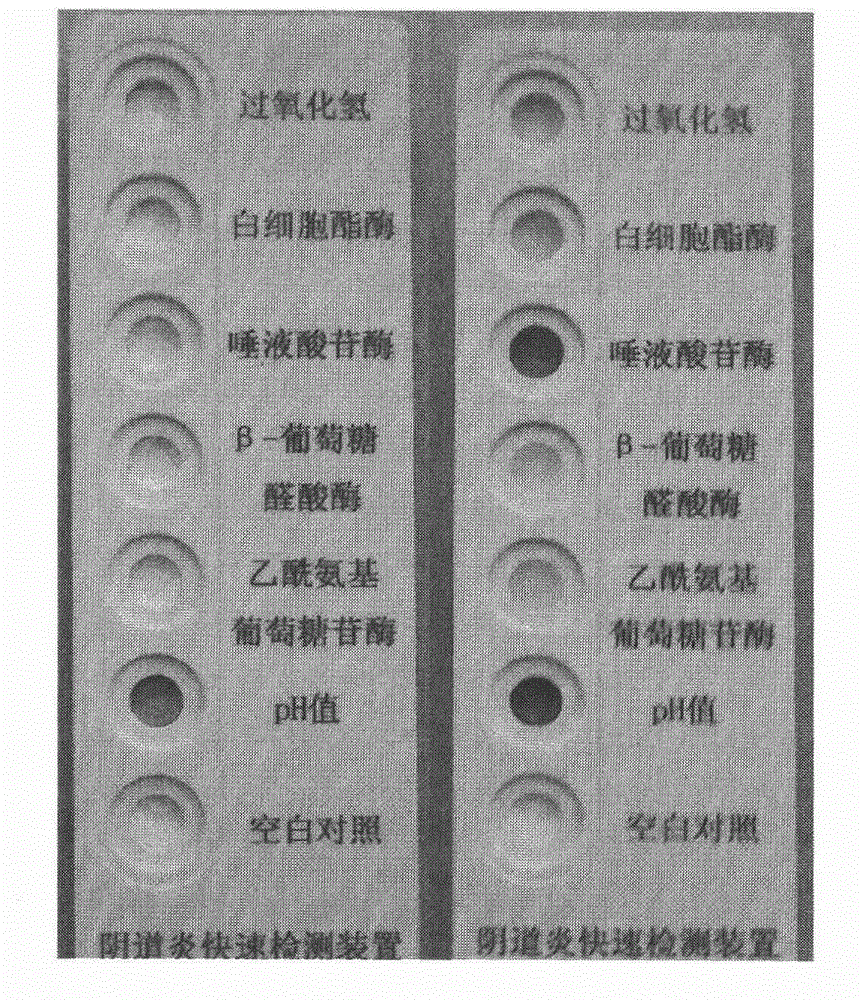 Vaginitis test kit and preparation method thereof