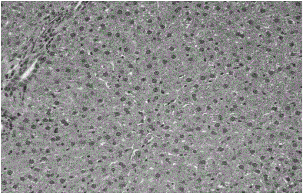 Medicinal and edible composition for hepatic disease with malnutrition, as well as preparation and preparation application of medicinal and edible composition