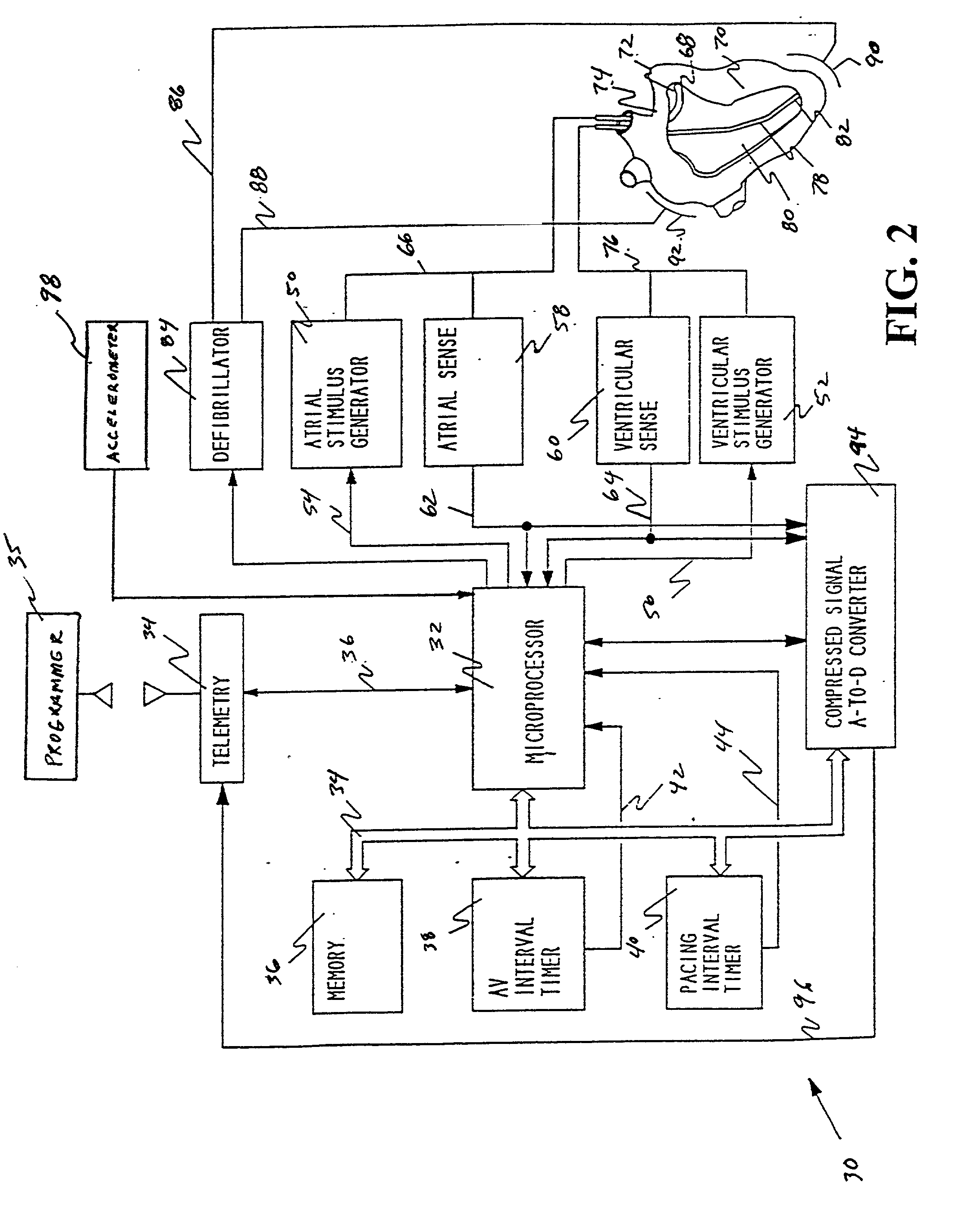 Methods and apparatus for tachycardia rate hysteresis for dual-chamber cardiac stimulators