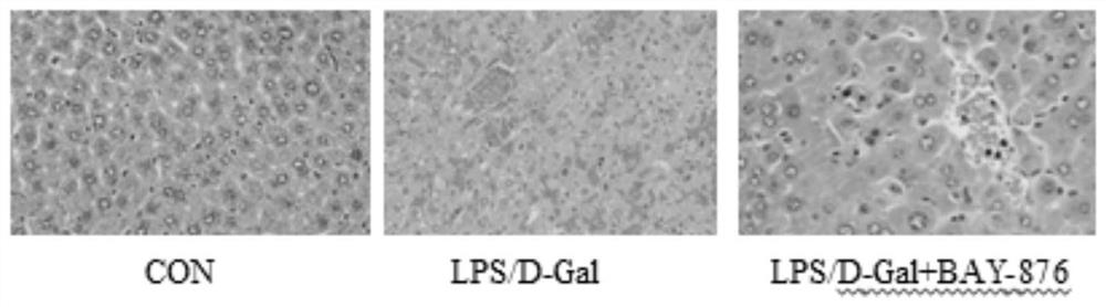 Use of compound bay-876 in the preparation of medicines for treating and/or preventing liver damage