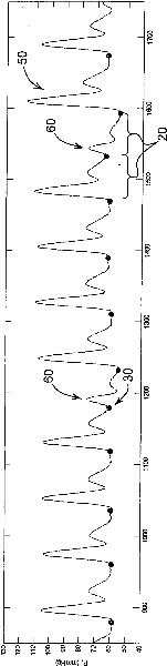 Assessment of preload dependence and fluid responsiveness