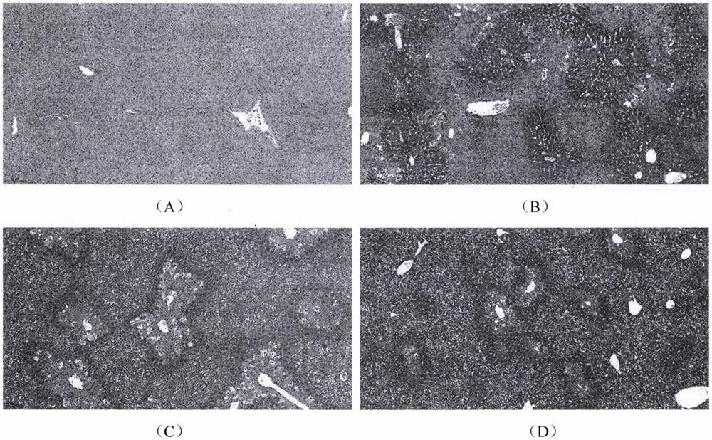 Application of cajanin in preparation of medicine for preventing and/or treating medicine-induced liver injury