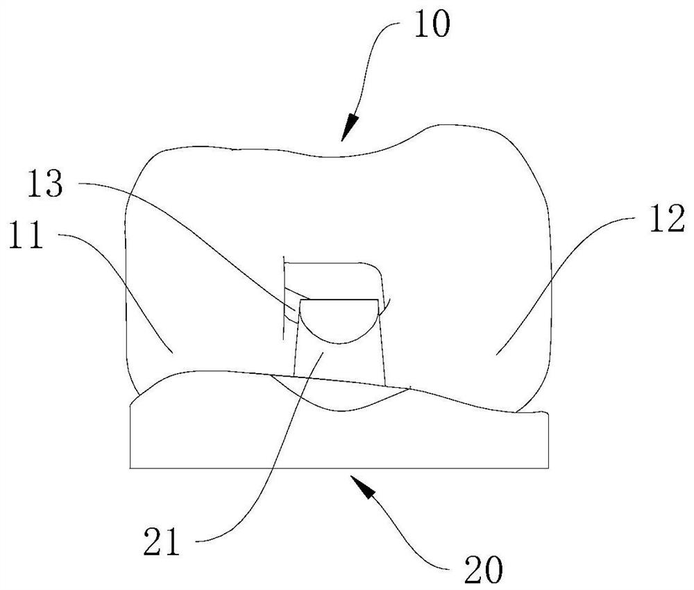 Knee prosthesis