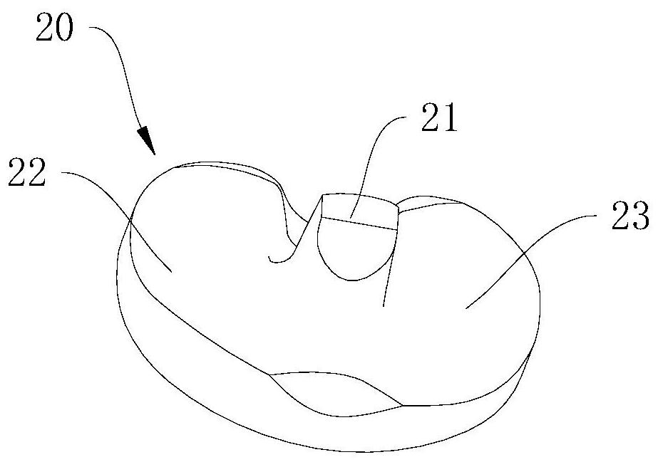 Knee prosthesis