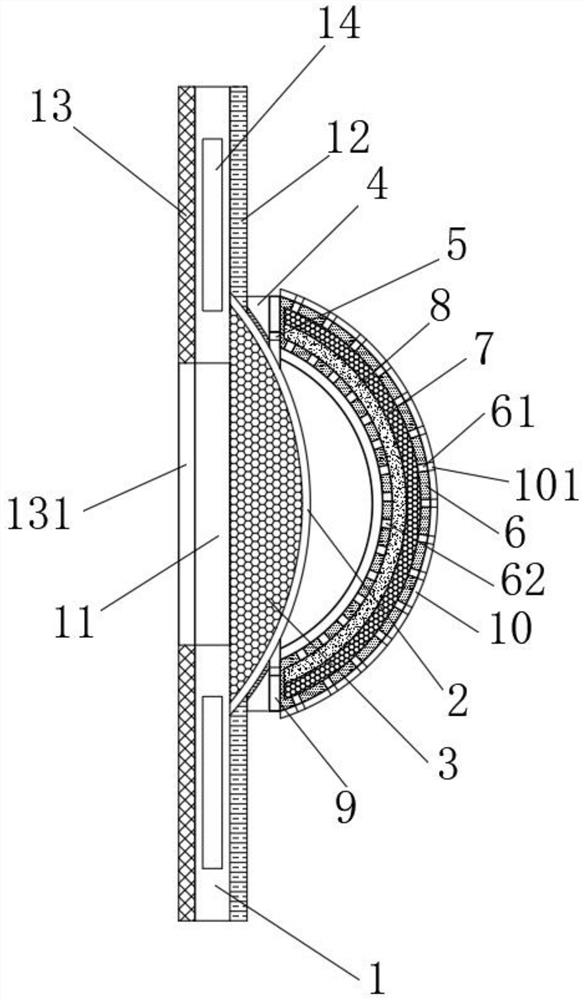 Static orthodontic brace for knee joint osteoarthrosis