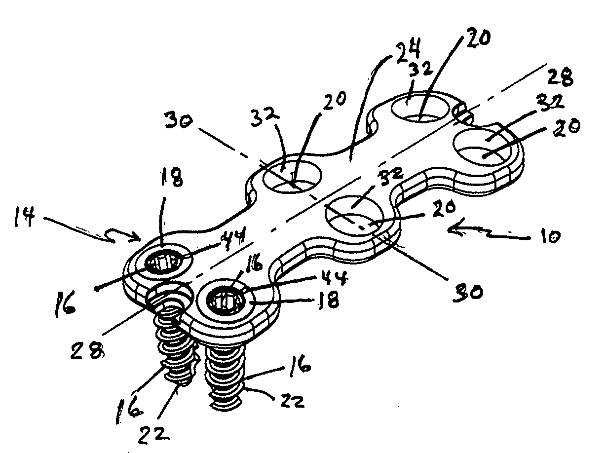 Anterior vertebral plate with taper lock screw