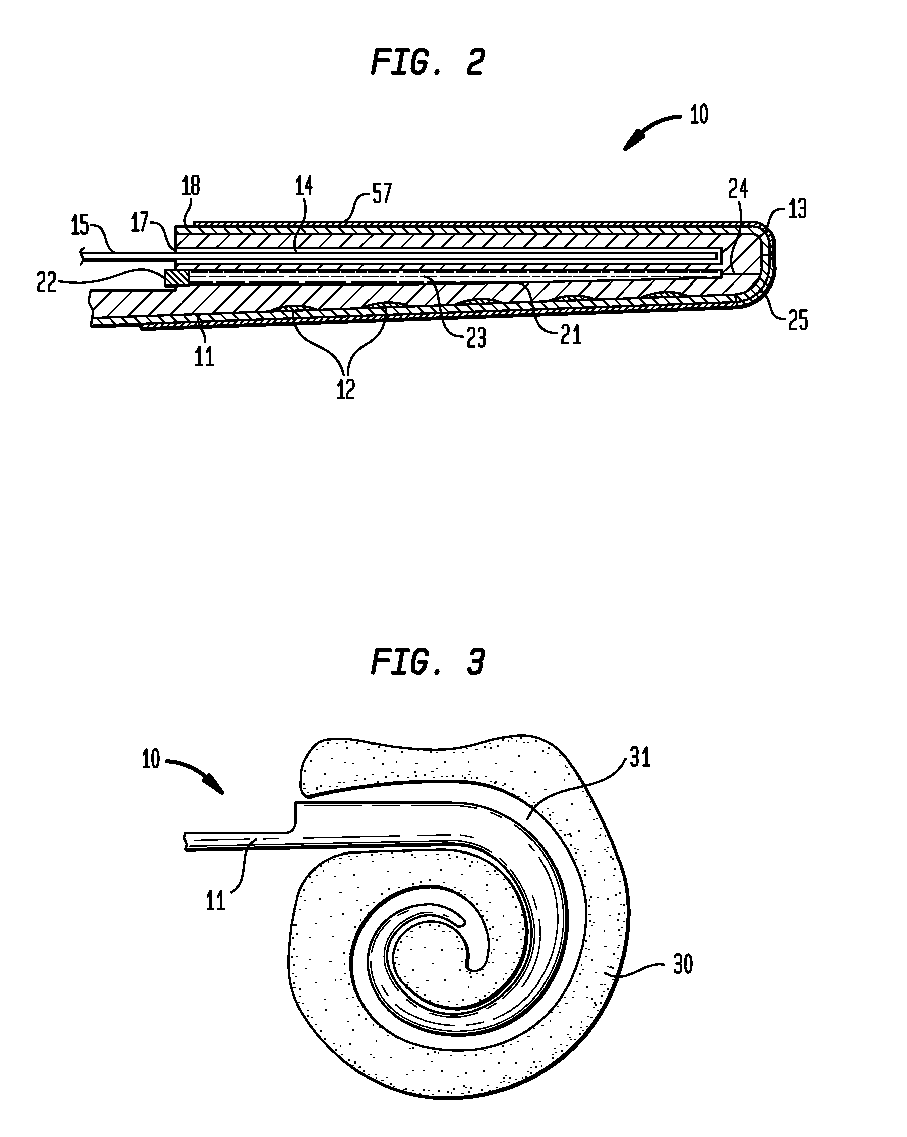 Apparatus for delivery of pharmaceuticals to the cochlea