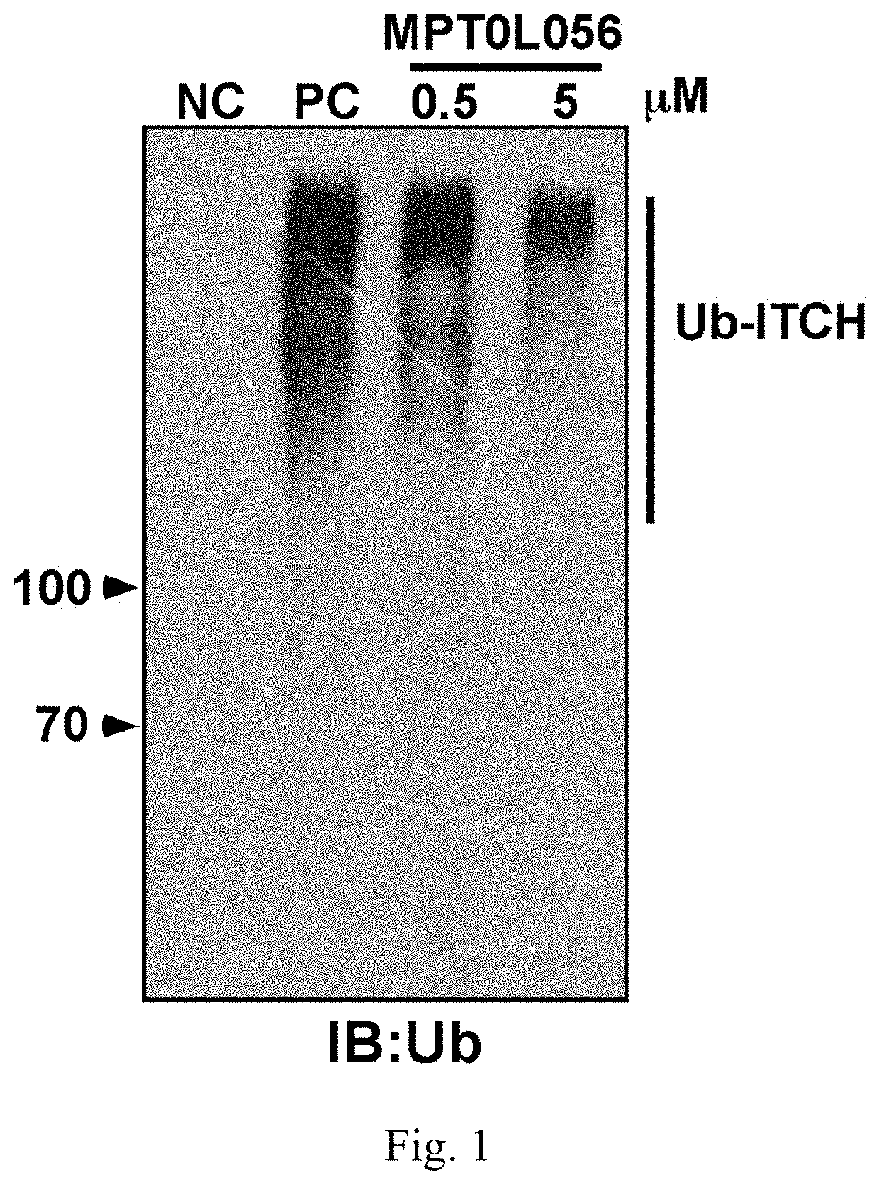 Aminonapthoquinone compounds and pharmaceutical composition for blocking ubiquitination-proteasome system in diseases