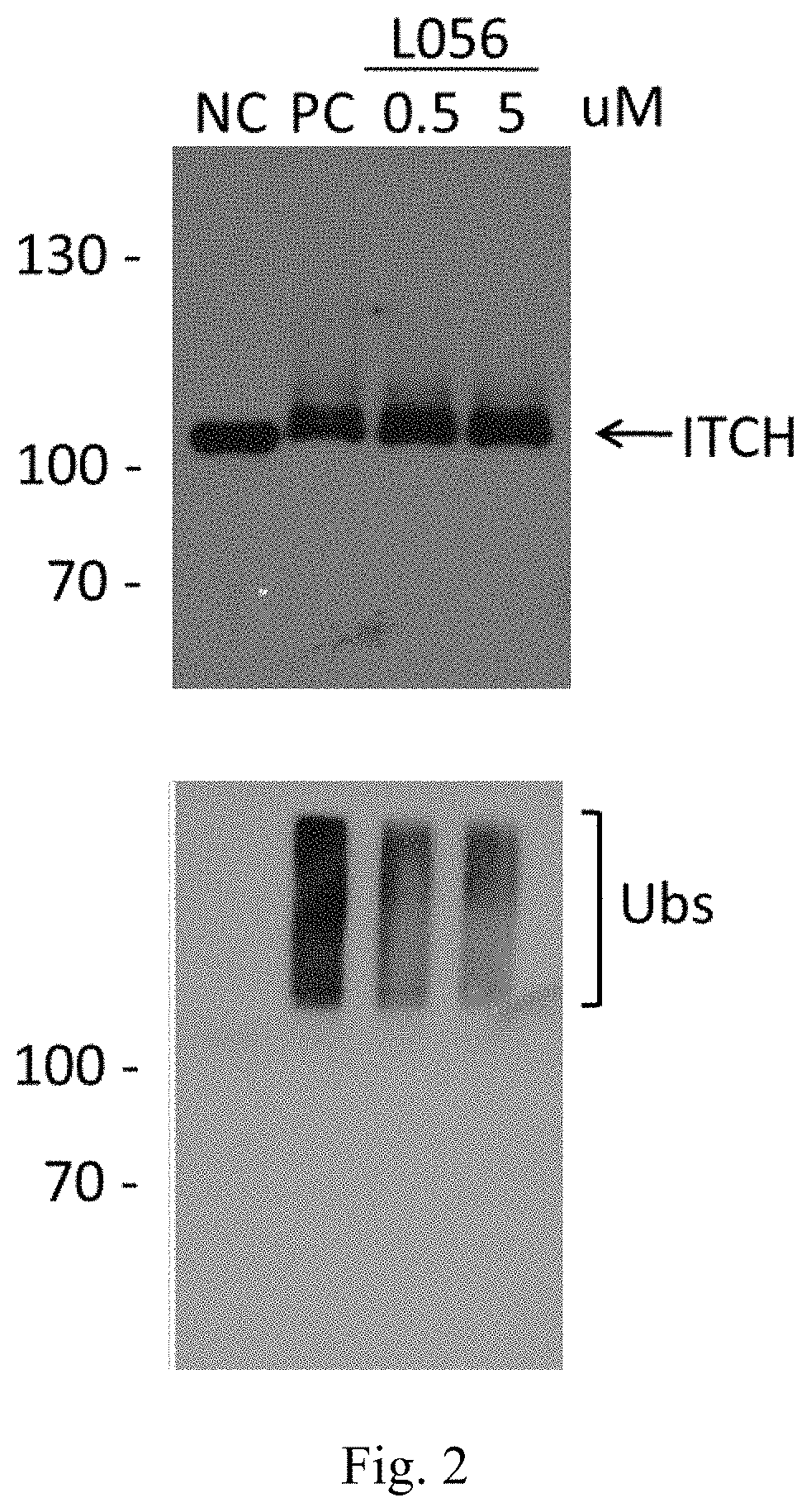 Aminonapthoquinone compounds and pharmaceutical composition for blocking ubiquitination-proteasome system in diseases