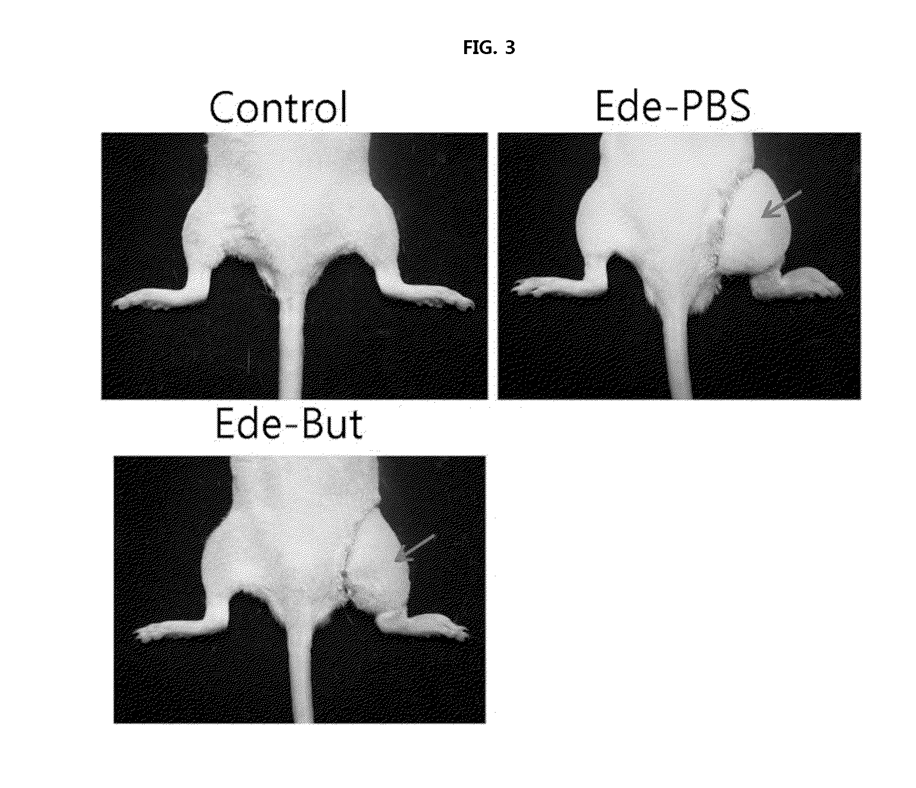 Composition for preventing or treating edema containing flavonoid compound