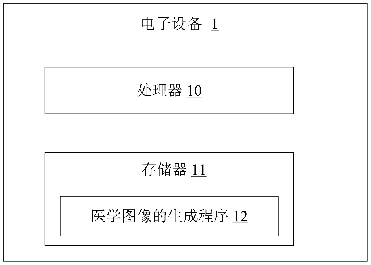 Medical image generation method and device, electronic equipment and medium