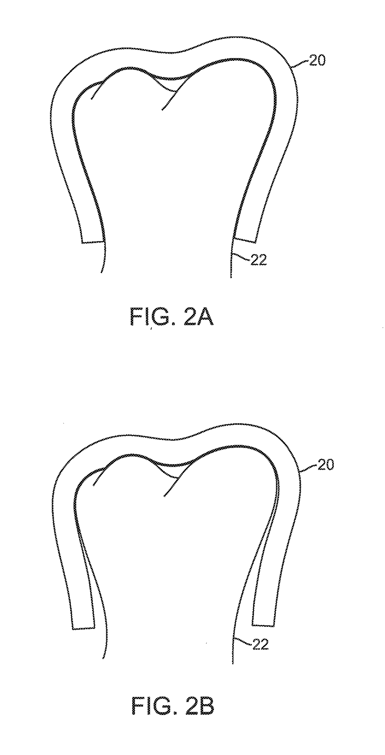 Shape engineered aligner - auto shaping