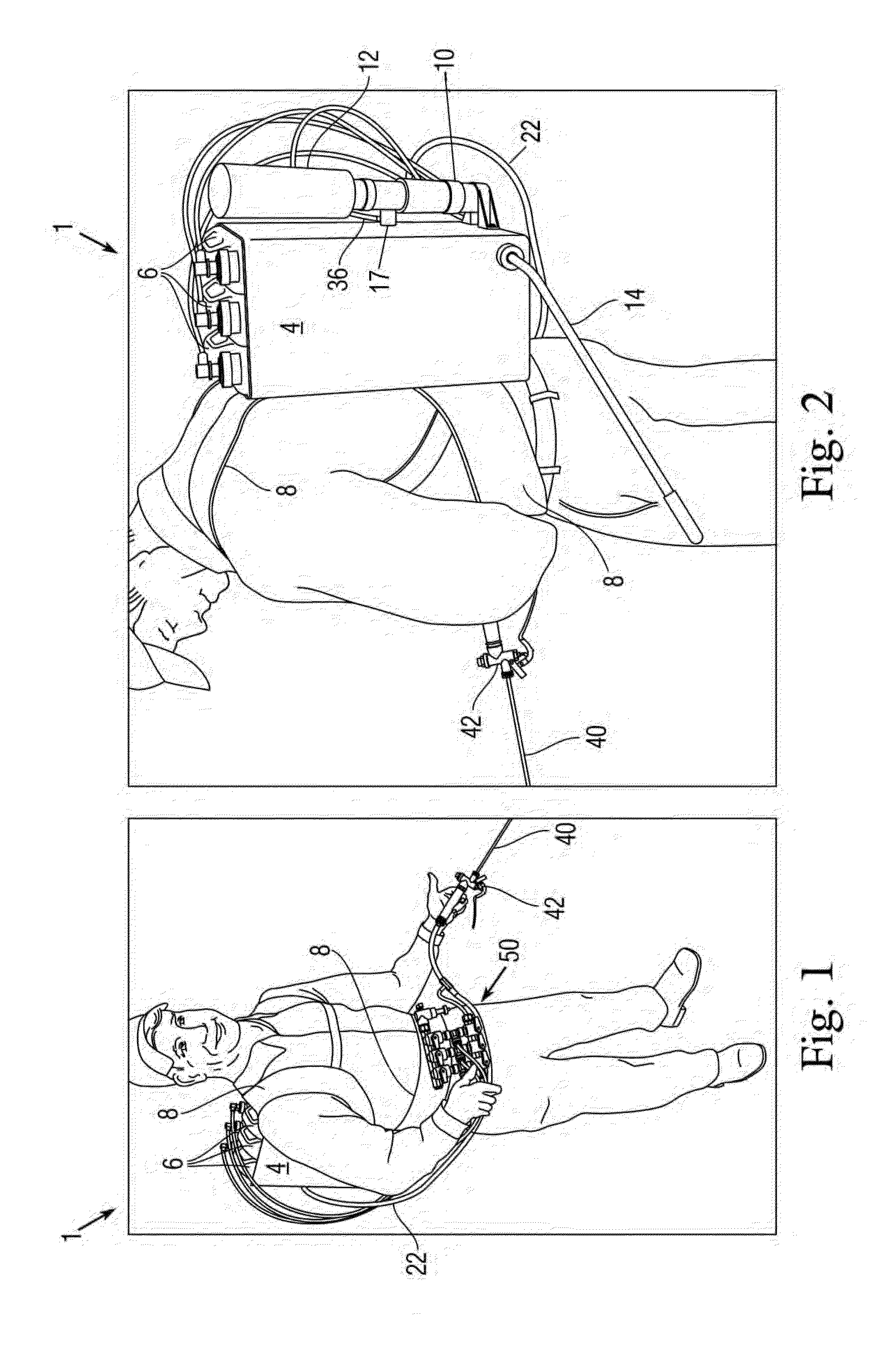 Multi-container backpack style sprayer