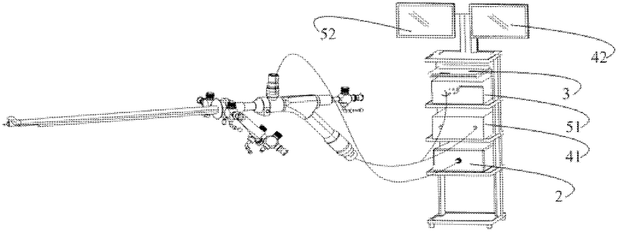 OCT (optical coherence tomographic) rigid cystoscopy system