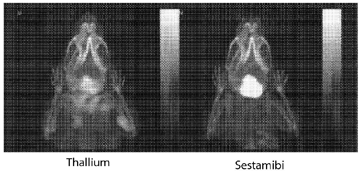 Compositions and methods for assessing neuromuscular function