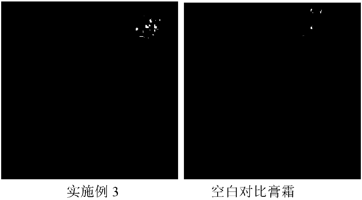 Sponge micro-needle containing cosmetic composition capable of promoting transdermal absorption