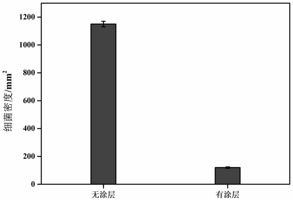 A kind of ureter catheter and preparation method thereof