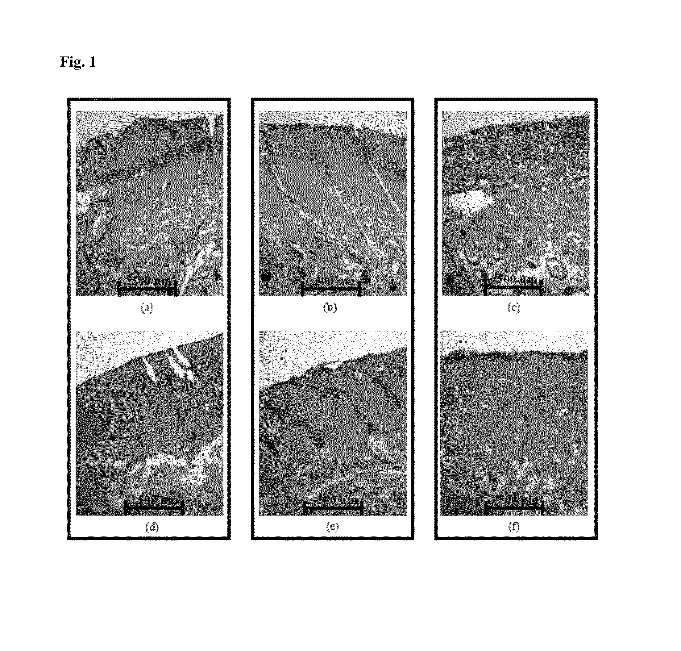 Methods and systems for assessing a burn injury