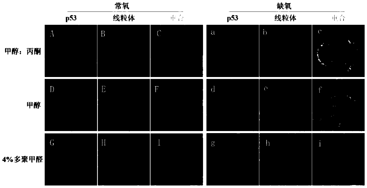 P53 protein and mitochondria double-labeled immunofluorescence detection method and kit thereof