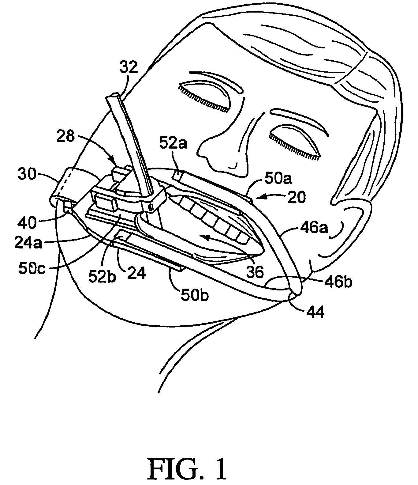 Endotracheal tube holder