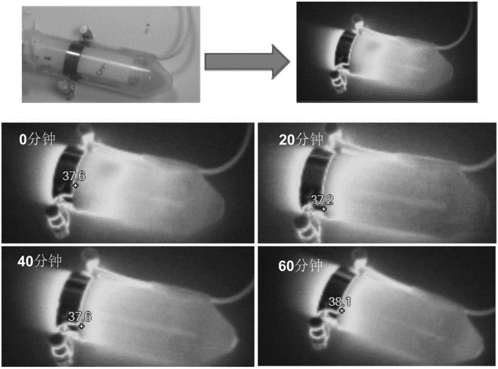 Radiofrequency treatment system