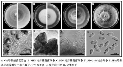 Biocontrol Phoma macrostoma strain P2 and application thereof