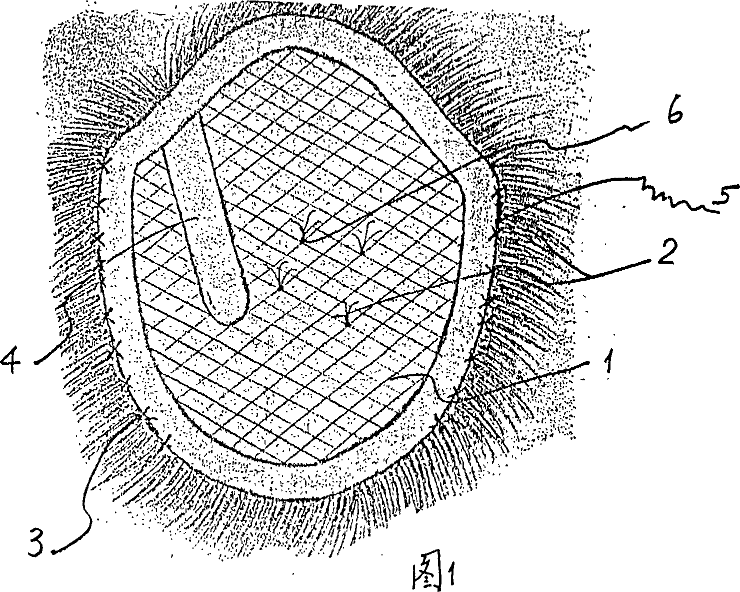 Flexible plastic bald-repairing decorative wig and its making method