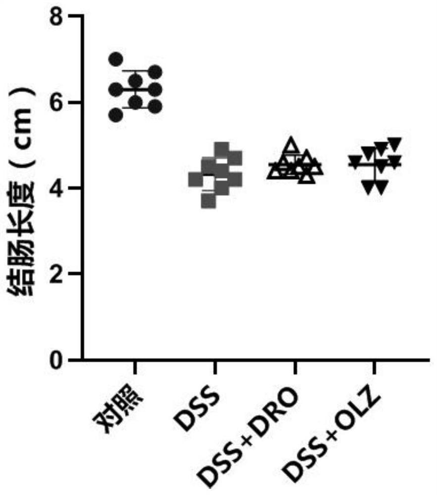 Application of dronedarone to preparation of medicine for preventing and treating colitis