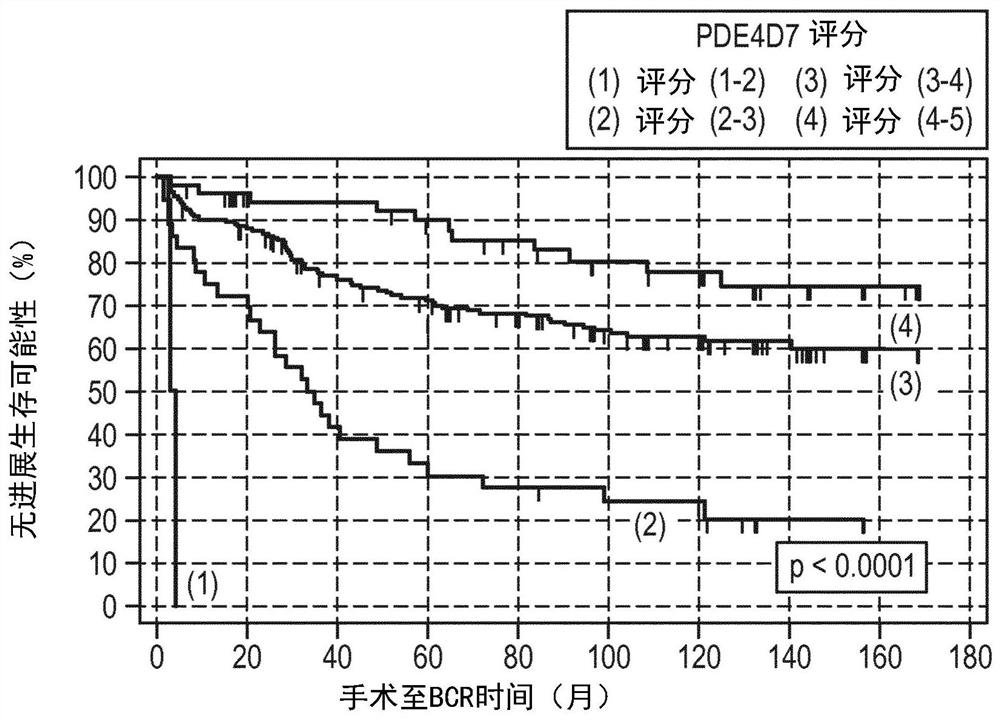 Post-surgical risk stratification based on pde4d variant expression, selected according to tmprss2-erg fusion status, and post-surgical clinical variables