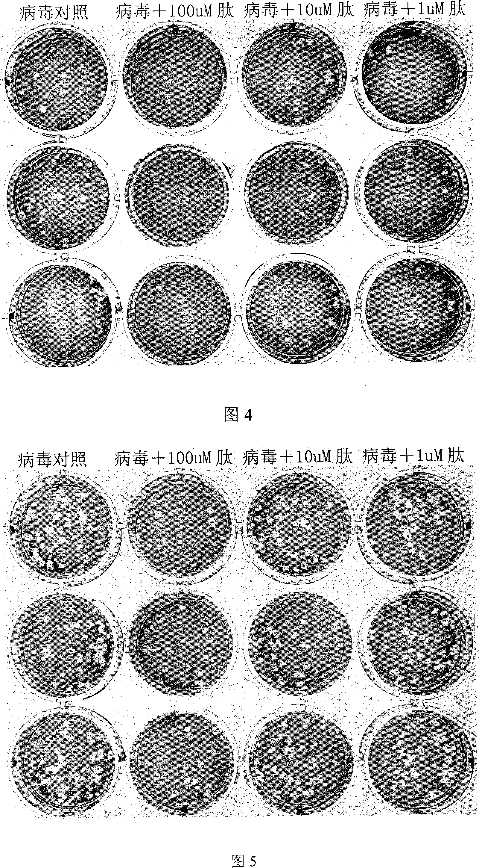 Method for inhibiting influenza virus infection and medicament thereof