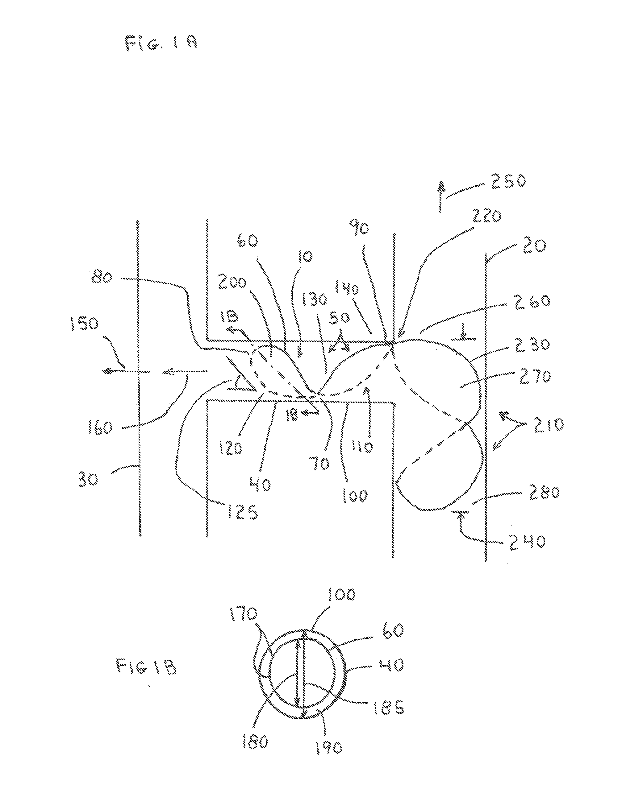 Branch and Truncal Vessel Occluder