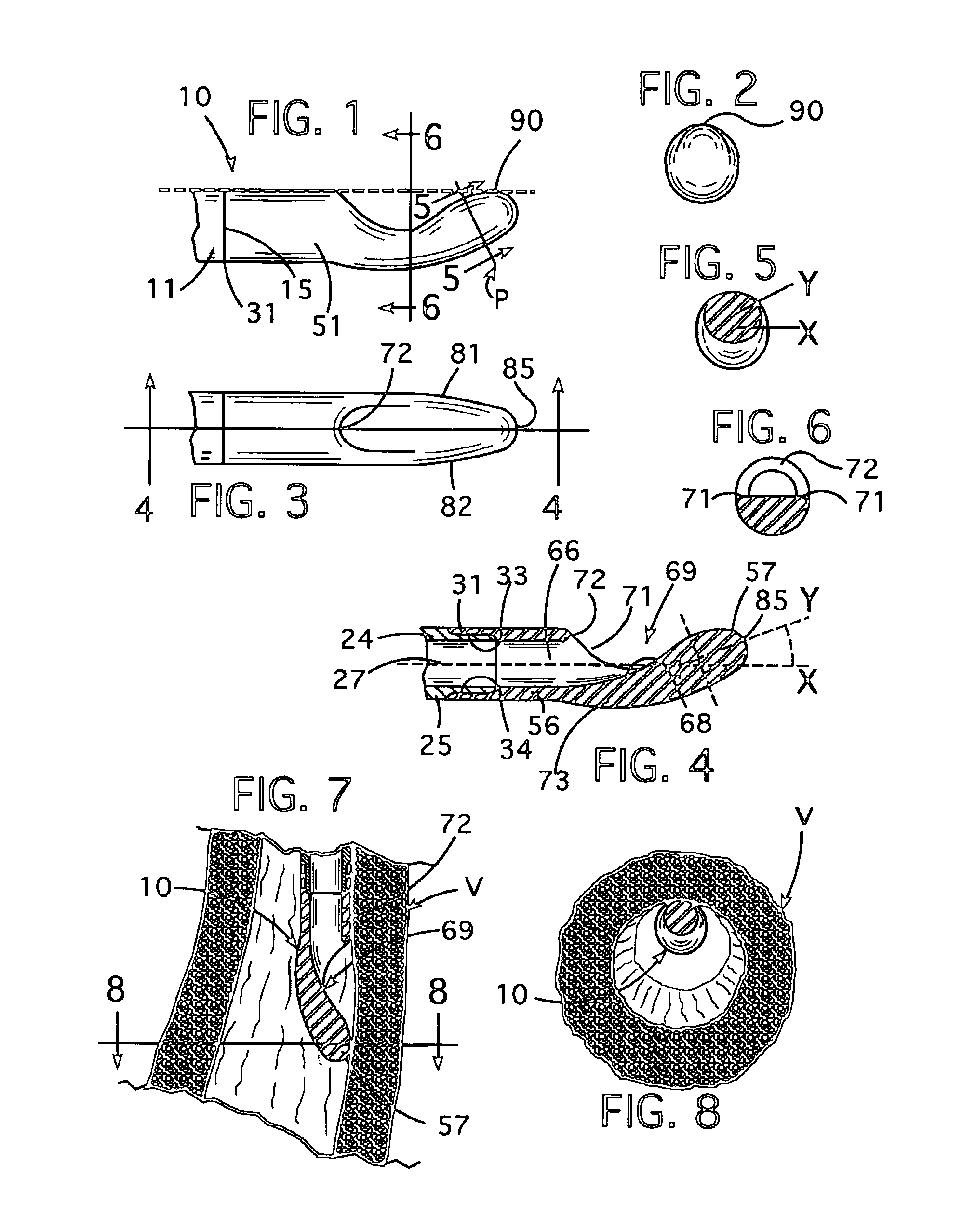 Blood vessel catheter