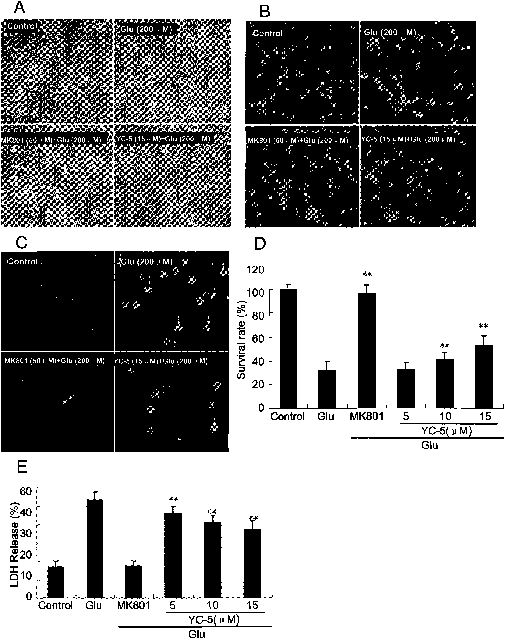 Application of cholestane-3 beta, 5 alpha, 6 beta-triol in preparation of neuronal protection medicine