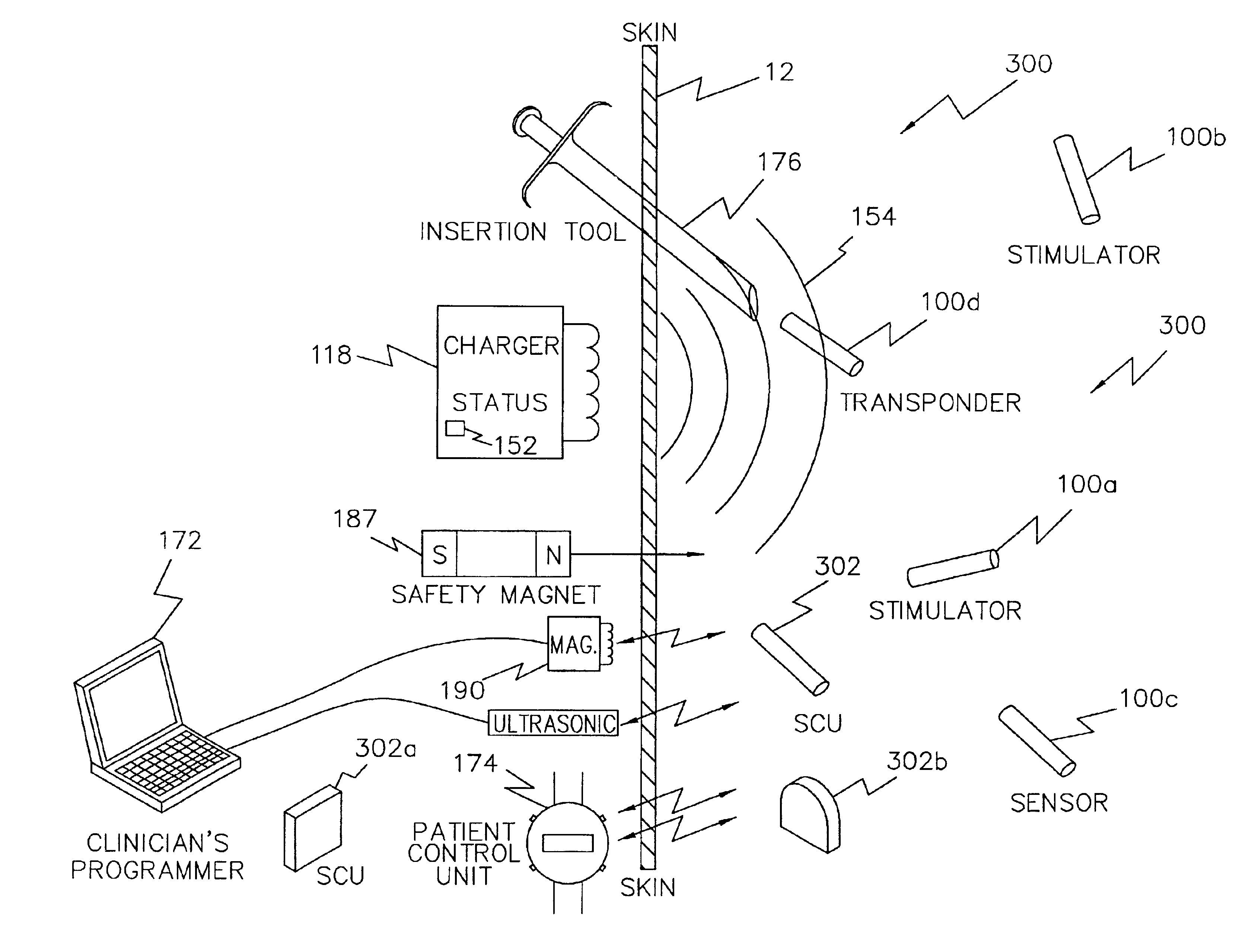 Magnet control system for battery powered living tissue stimulators